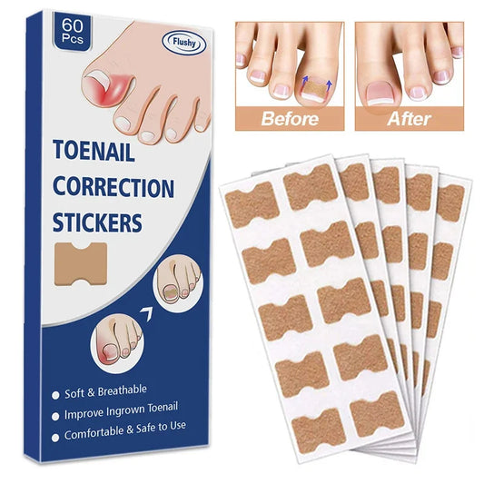 60Pcs Ingrown Nail Correction Stickers