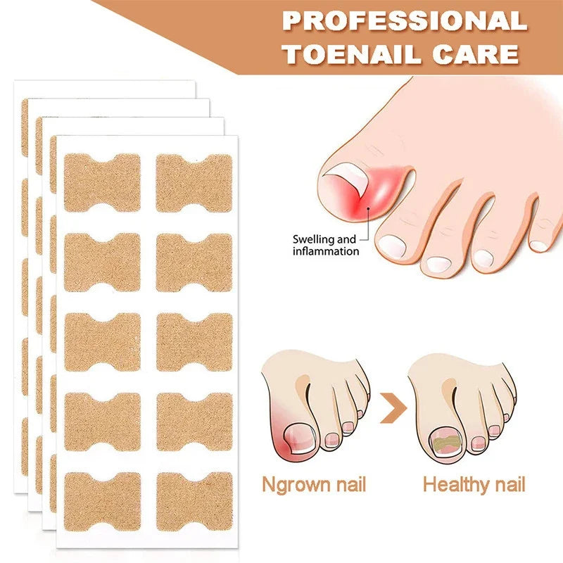 60Pcs Ingrown Nail Correction Stickers