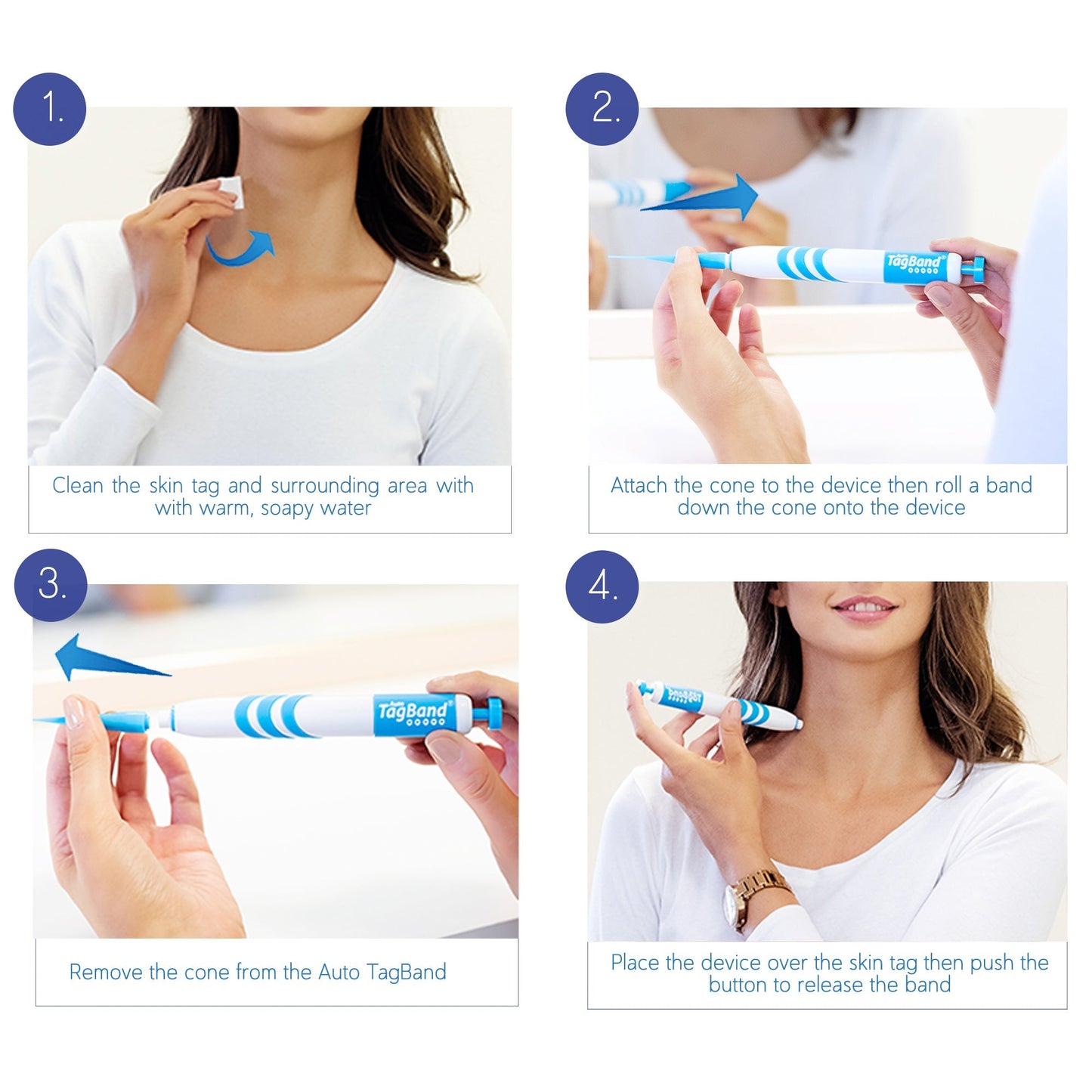 Auto TagBand® - Skin Tag Removal Kit